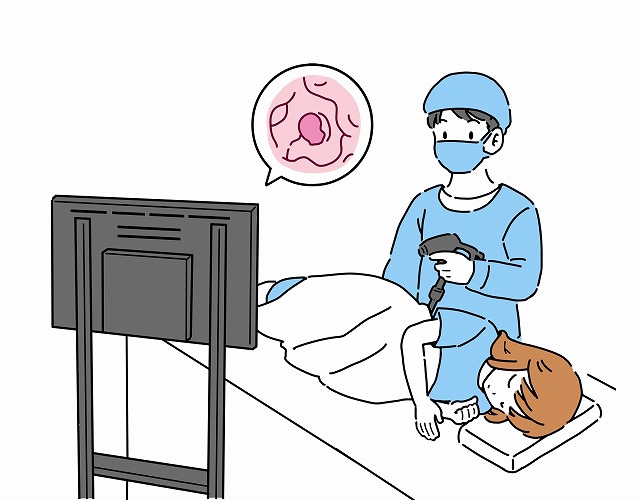女性にも増えている胃がん・大腸がん、定期的な検査が大切です
